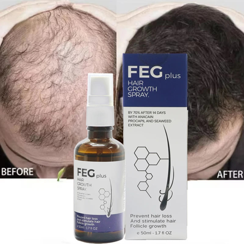 FEG Plus Organic Hair Growth Treatment Oil - زيت فيج بلس العضوي لعلاج نمو الشعر