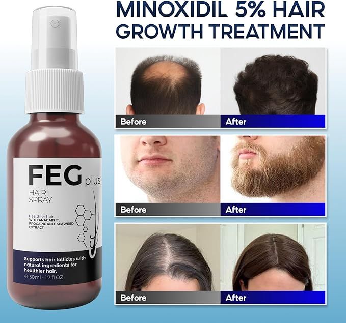 FEG Plus Organic Hair Growth Treatment Oil - زيت فيج بلس العضوي لعلاج نمو الشعر